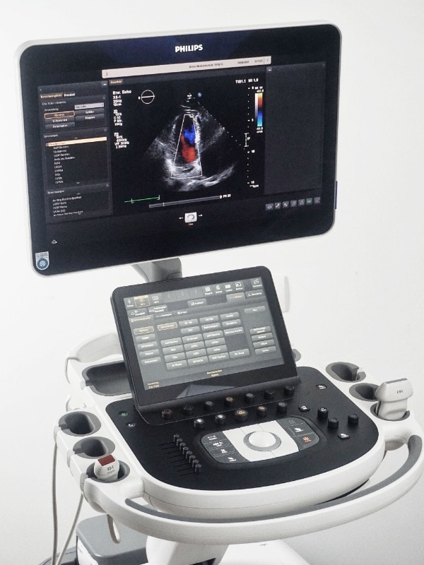 аппарат УЗИ в Родной клинике